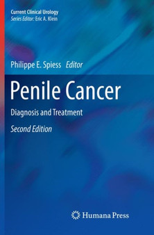 Penile Cancer : Diagnosis and Treatment by Philippe E. Spiess - Paperback
