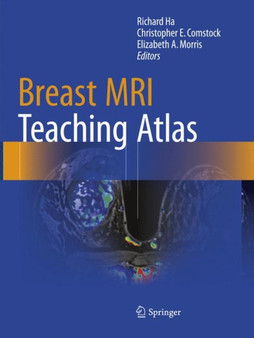 Breast MRI Teaching Atlas by Richard Ha - Paperback