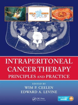 Intraperitoneal Cancer Therapy : Principles and Practice by Wim P. Ceelen - Hardback