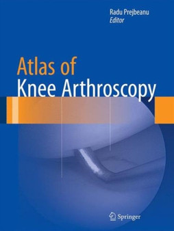 Atlas of Knee Arthroscopy by Radu Prejbeanu - Hardback