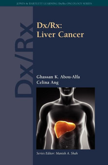 Dx/Rx: Liver Cancer : Liver Cancer by Ghassan K. Abou-Alfa - Paperback
