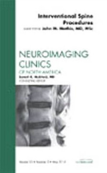 Image-Guided Spine Interventions, An Issue of Neuroimaging Clinics : Volume 20-2 by John M. M.D. Mathis - Hardback