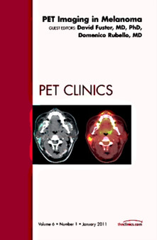 Pet Imaging in Melanoma, An Issue of PET Clinics : Volume 6-1 by Domenico Rubello - Hardback Pet Imaging in Melanoma, An Issue of PET Clinics : Volume 6-1 by Domenico Rubello - Hardback