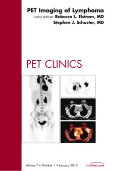 PET Imaging of Lymphoma, An Issue of PET Clinics : Volume 7-1 by Rebecca Elstrom - Hardback PET Imaging of Lymphoma, An Issue of PET Clinics : Volume 7-1 by Rebecca Elstrom - Hardback