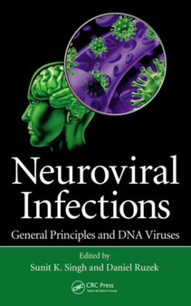 Neuroviral Infections : General Principles and DNA Viruses by Sunit K. Varanasi India) Singh - Hardback
