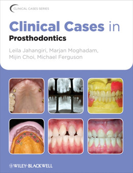 Clinical Cases in Prosthodontics by Leila Jahangiri - Paperback