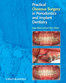 Practical Osseous Surgery in Periodontics and Implant Dentistry by Serge Dibart - Hardback