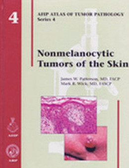 Nonmelanocytic Tumors of the Skin by James W. Patterson - Hardback
