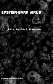 Epstein-Barr Virus by Erle S. Robertson - Hardback