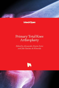 Primary Total Knee Arthroplasty by Alessandro Rozim Zorzi - Hardback