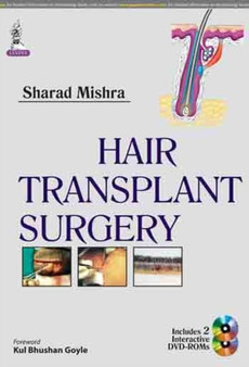 Hair Transplant Surgery by Sharad Mishra - Hardback