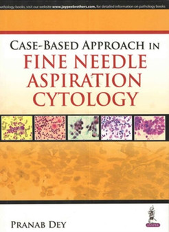 Case-Based Approach in Fine Needle Aspiration Cytology by Pranab Dey - Paperback