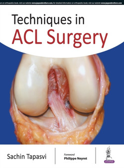 Techniques in ACL Surgery by Sachin Tapasvi - Hardback