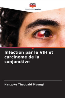 Infection par le VIH et carcinome de la conjonctive by Nanzoke Theobald Mvungi - Paperback