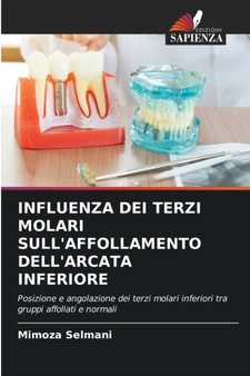 Influenza Dei Terzi Molari Sull'affollamento Dell'arcata Inferiore by Mimoza Selmani - Paperback
