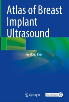 Atlas of Breast Implant Ultrasound by Jae Hong Kim - Hardback