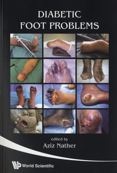 Diabetic Foot Problems by Abdul Aziz Nather - Paperback