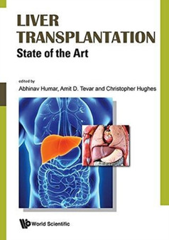 Liver Transplantation: State Of The Art by Abhinav Humar - Hardback