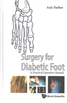 Surgery For Diabetic Foot: A Practical Operative Manual by Abdul Aziz Nather - Hardback