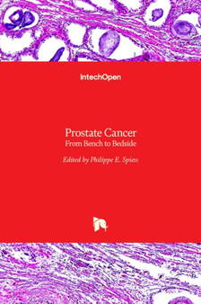 Prostate Cancer : From Bench to Bedside by Philippe E. Spiess - Hardback