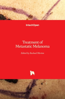 Treatment of Metastatic Melanoma by Rachael Morton - Hardback