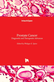 Prostate Cancer : Diagnostic and Therapeutic Advances by Philippe E. Spiess - Hardback