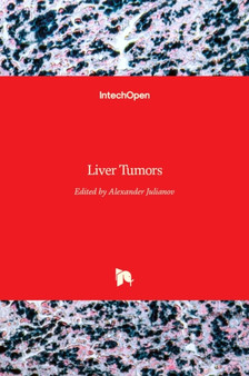 Liver Tumors by Alexander Julianov - Hardback