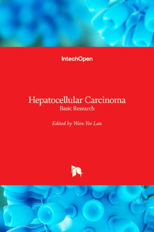Hepatocellular Carcinoma : Basic Research by Wan-Yee Lau - Hardback