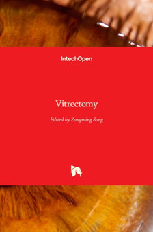 Vitrectomy by Zongming Song - Hardback