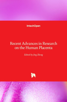 Recent Advances in Research on the Human Placenta by Jing Zheng - Hardback