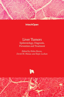 Liver Tumors : Epidemiology, Diagnosis, Prevention and Treatment by Helen Reeves - Hardback
