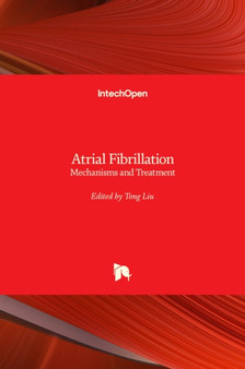 Atrial Fibrillation : Mechanisms and Treatment by Tong Liu - Hardback