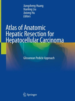 Atlas of Anatomic Hepatic Resection for Hepatocellular Carcinoma : Glissonean Pedicle Approach by Jiangsheng Huang - Hardback