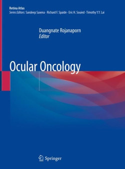 Ocular Oncology by Duangnate Rojanaporn - Hardback