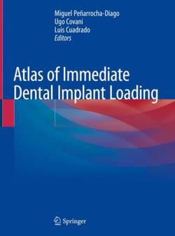 Atlas of Immediate Dental Implant Loading by Miguel Penarrocha-Diago - Hardback