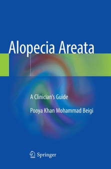 Alopecia Areata : A Clinician's Guide by Pooya Khan Mohammad Beigi - Paperback