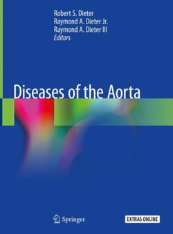 Diseases of the Aorta by Robert S. Dieter - Hardback