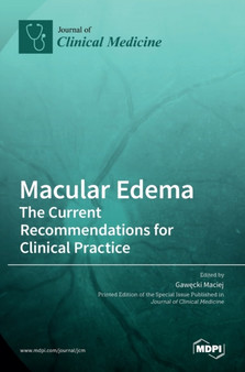 Macular Edema : The Current Recommendations for Clinical Practice by Gawecki Maciej - Hardback