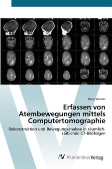 Erfassen von Atembewegungen mittels Computertomographie by Rene Werner - Paperback