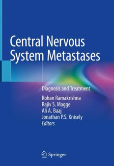 Central Nervous System Metastases : Diagnosis and Treatment by Rohan Ramakrishna - Hardback