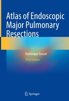 Atlas of Endoscopic Major Pulmonary Resections by Dominique Gossot - Hardback