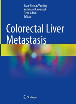 Colorectal Liver Metastasis by Jean-Nicolas Vauthey - Hardback