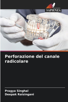 Perforazione del canale radicolare by Pragya Singhal - Paperback