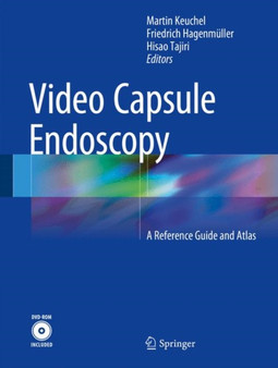Video Capsule Endoscopy : A Reference Guide and Atlas by Martin Keuchel - Hardback