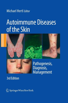 Autoimmune Diseases of the Skin : Pathogenesis, Diagnosis, Management by Michael Hertl - Paperback