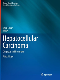 Hepatocellular Carcinoma : Diagnosis and Treatment by Brian I. Carr - Paperback