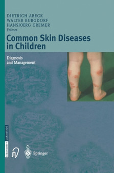 Common Skin Diseases in Children : Diagnosis and Management by Dietrich Abeck - Hardback