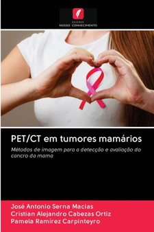 PET/CT em tumores mamarios by Jose Antonio Serna Macias - Paperback