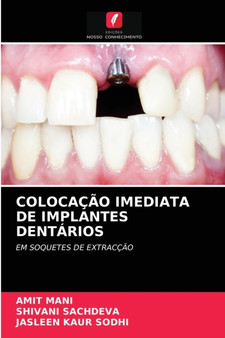 Colocacao Imediata de Implantes Dentarios by Amit Mani - Paperback