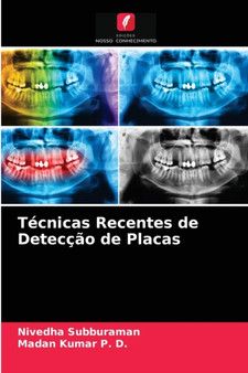 Tecnicas Recentes de Deteccao de Placas by Nivedha Subburaman - Paperback